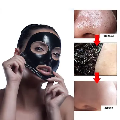 Blackhead Removal Strips Nose Face Mask Deep Cleansing Pore Treatment Masks New  • £3.49