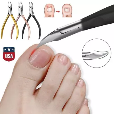 Professional Ingrown Toenail Tool Kit Toe Nail Clipper Set For Pedicure Manicure • $9.09