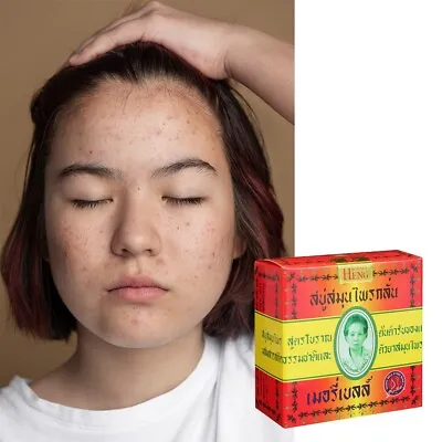 MADAME HENG SOAP ORIGINAL HERBAL MERRY BELL BODY FACE ANTI-ACNE Natural 160g • $18.64