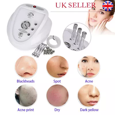 New Diamond Microdermabrasion Dermabrasion Machine Anti-wrinkle Peel Skin Spa UK • £92.01