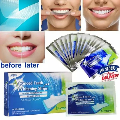 $12.99 • Buy 28 White Strip Teeth Whitening Strips Professional Advanced VW Tooth Bleaching