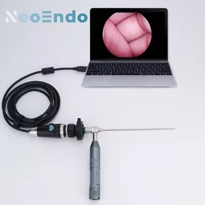 Medical USB Endoscope Camera Full HD 1080P For ENT/Oral/Pet Inspection • $500