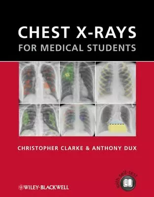 Chest X-Rays For Medical Students By Clarke Christopher; Dux Anthony • $11.51