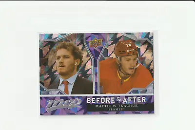 2021 Upper Deck MVP Matthew Tkachuk BA-16 Before After Insert (b) • $7