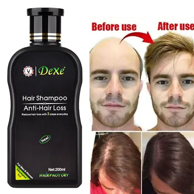 Fast Hair Growth Shampoo For Women Men Anti Hair Loss Treatment Care Thickening • £9.25