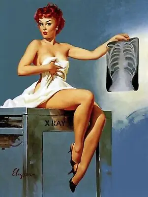 Display Her Chest X-ray Gil Elvgren High Quality Metal Magnet 3 X 4 8373 • $5.95