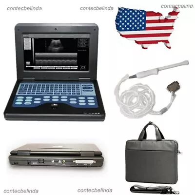 CONTEC Portable Ultrasound Scanner Laptop Machine 6.5Mhz Transvaginal Probe USA • £1069.35