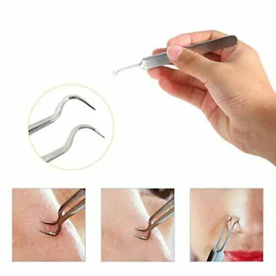 $5.79 • Buy Curved Tweezers Blackhead Remover Pimple Extractor Popper Acne Blemish Comedone