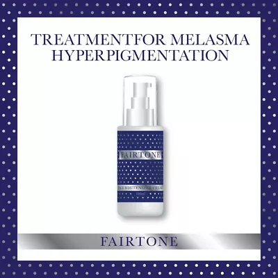 Fairtone Face Whitenizer Cream Treatment For Melasma Hyperpigmentation • £23.99