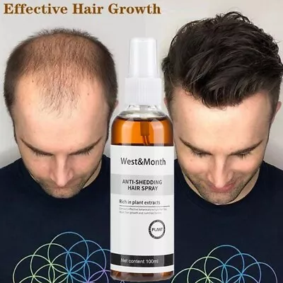 Anti-Shedding Hair Spray Hair Loss Treatment Solution Hair Growth Spray For Men • $9.95