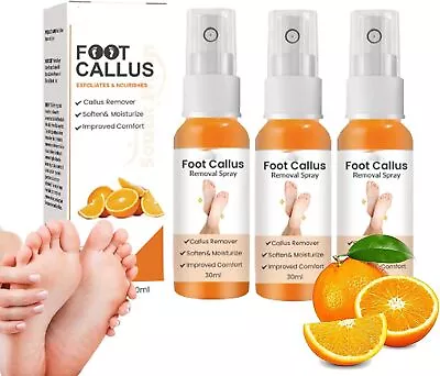 Foot Callus Removal Spray Foot Heel Callus Remover Spray Foot Peel Spray • £4.31