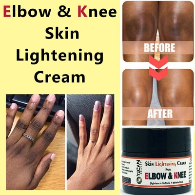 $21.70 • Buy Dark Skin Bleach Body Bleaching Cream Max Strength Whitening Lightening AHA 25gm