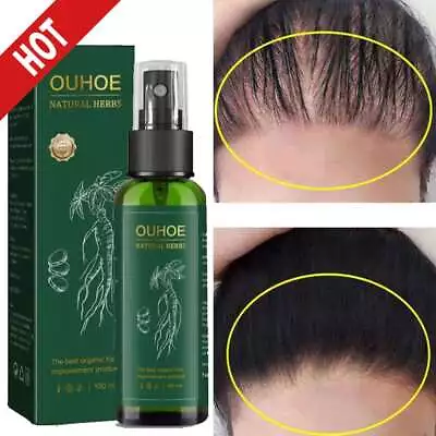 £7.45 • Buy 100ml Hair Thickening Spray For Hair Growth Serum Spray - BIOTIN & GINSENG UK