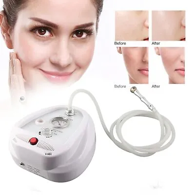 Face Cleaning Machine Comfortable Microdermabrasion Machine For Nose For Neck • £107.19