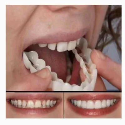 Snap On Pair Upper And Lower Smile Cosmetic Dental White Teeth Denture Veneers   • $15.99