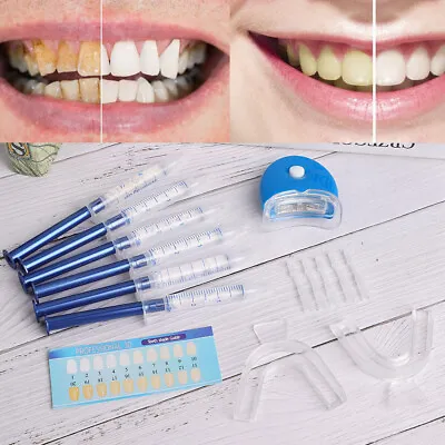 $17.01 • Buy 18ml Teeth Whitening Gel Dental Tray LED Cold Light Color Card Dental Teeth DY9