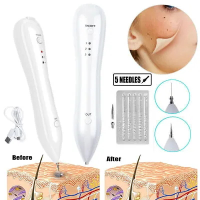 Laser Plasma Skin Tag Freckle Wart Dot Mole Remove Pen Dark Spot Tattoo Removal • $13.77