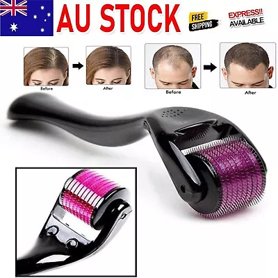 $17.99 • Buy 0.5mm 540 Titanium Microneedle Scar Micro Needle Hair Loss Face Derma Roller 