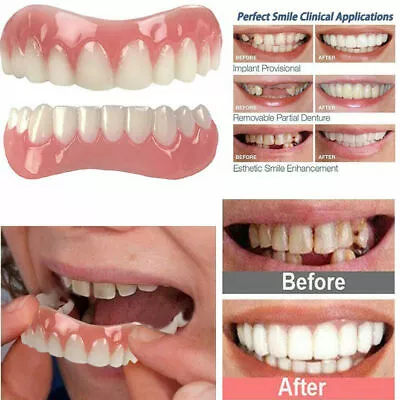 Beauty Instant Dental Veneers Cover Cap Smile Flex Cosmetic Hidden Teeth Dentur/ • $11.90