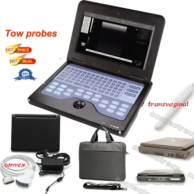 £1468 • Buy CE Digital Portable Ultrasound Scanner B Ultrasonic Machine+convex,transvaginal