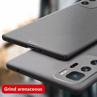 For Xiaomi Redmi Note 12 11 10  Mi 11 Shockproof Ultra-thin  PC Hard Case Cover • $4.68