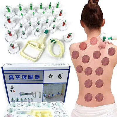 $20.58 • Buy 24 Cups Vacuum Cupping Chinese Medical Suction Body Massage Health Care Massager