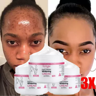 $15.45 • Buy 3PACK Dark Skin Permanent Bleaching Cream Body Whitening Lightening Brightening