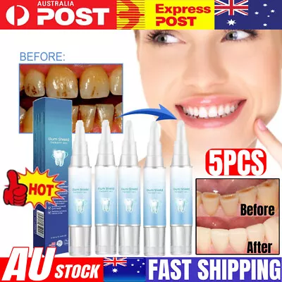 5PCS NESLEMY Gum Shield Therapy Gel NESLEMY Gum Shield Gel Dentizen ~ AU 🔥 • $17.29