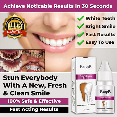 New Instant Tooth Whitening Kit White Teeth Clean Gel Uv Bleach Dental Strength • $24.95