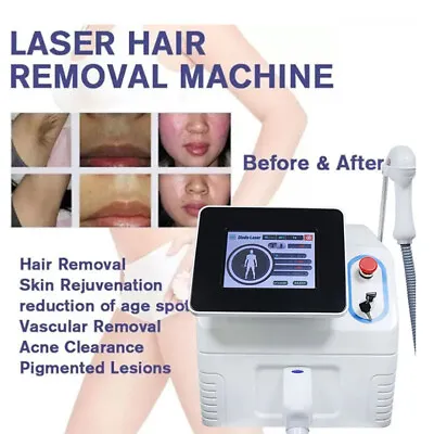 Carbon Peel Picosecond Laser Hair Removal Machine Q Switched Nd Yag Laser 808nm • $997.99