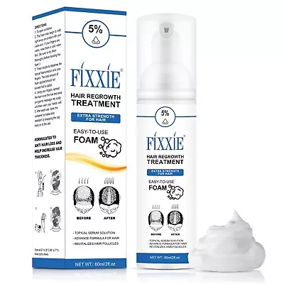 FIXXIE® 5% Hair Regrowth Treatment Hair Loss & Growth Scalp Foam 60ML Men/Women • £6.95