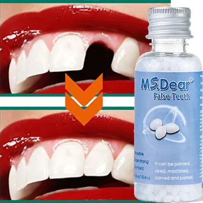 Permanent Strong Teeth Tooth Repair Dental Cement Cavity Filling Kit Fake Teeth~ • $8.78