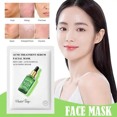Face Mask Face Sheet Whitening Moisturizer Acne Treatment M Seru R8P3 • $5.52