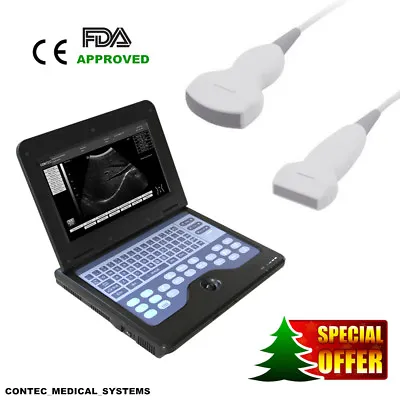 CE FDA Prove Portable Laptop Ultrasound Scanner Machine 2 Probes Convex & Linear • £1468