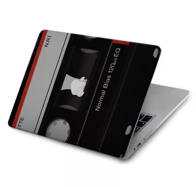 S3516 Vintage Cassette Tape Case For Apple Macbook • $44.99