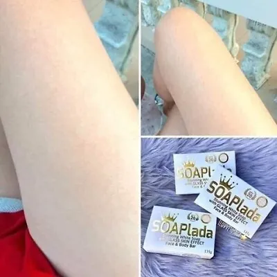 Soaplada Soap Instant Skin Whitening Fade Pimples L-Glutathione Kojic Acid More • $12