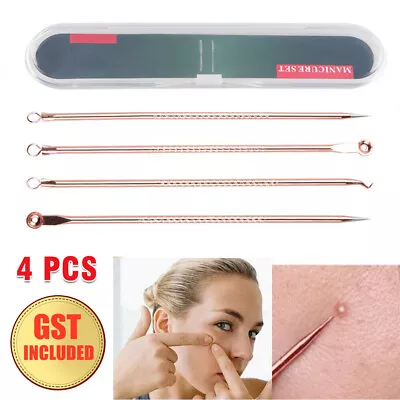 $4.72 • Buy 4pcs Blackhead Remover Pimple Tool Popper Pore Blemish Comedone Acne Cleaner Kit