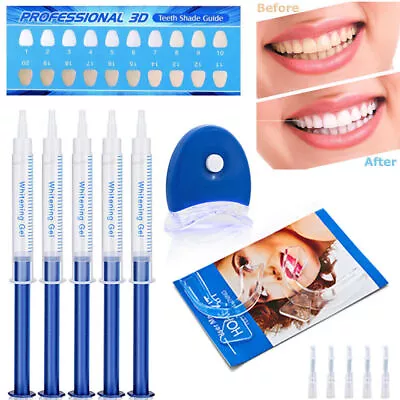 Teeth Whitening Gel Kits Strong Teeth Whitening Bleach Dental Extra White AU • $14.39