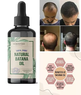 100% Organic Batana Oil From Honduras Natural Hair Growth (30ml - 1 Fl Oz) • $17.99