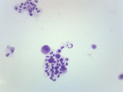 25PK Female Chromosome Smear Human - Microscope Slides - 75x25mm - Eisco Labs • $69.99