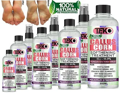 £4.59 • Buy CALLUS & CORN Remover Liquid - Treatment For Foot & Hand, Pain Free Removal 