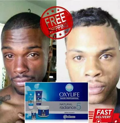 £7.85 • Buy New Dark Skin Oxy- Life Bleaching Cream Whitening Lightening Brightening 24g