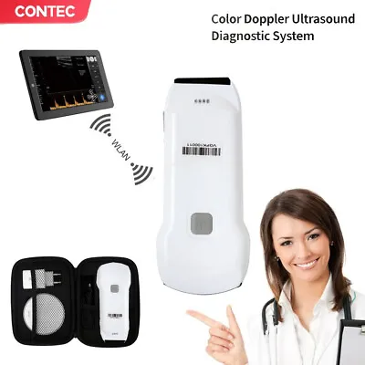 Wifi Wireless 3 In 1 Pocket Ultrasound Cardiac Linear Convex Color Dopplerbag • £1449