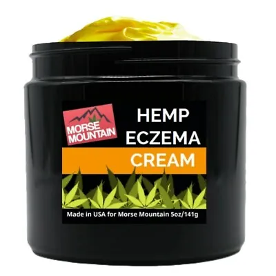 - PSORIASIS/ ECZEMA	SOOTHING CREAM 5OZ. – Rosacea Dermatitis And Shingles  • $21.67