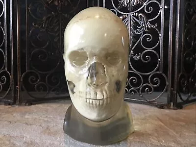 $6500 • Buy Vintage ACR Transparent Human Head X-Ray Phantom Skull Medical Radiology CT MRI