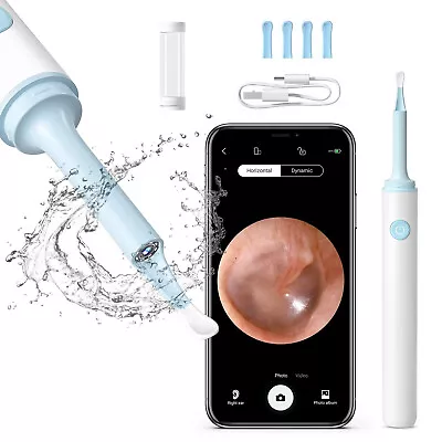 Wireless Visual Ear Endoscope Spoon Silicone Earpick 5MP Camera Ear Wax Remove • $12.20