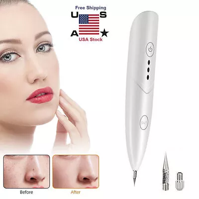 Laser Plasma Pen Mole Removal Dark Spot Skin Tag Tattoo Mole Wart Remover Pen US • $9.59