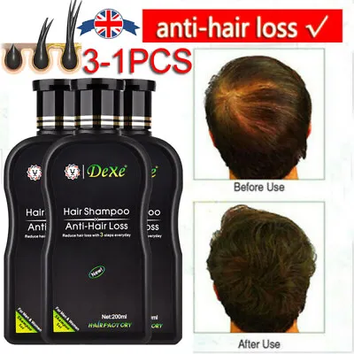 3/2~Dexe Anti Hair Loss Shampoo Chinese Herbal Hair Growth For Men & Women 200ml • £9.25
