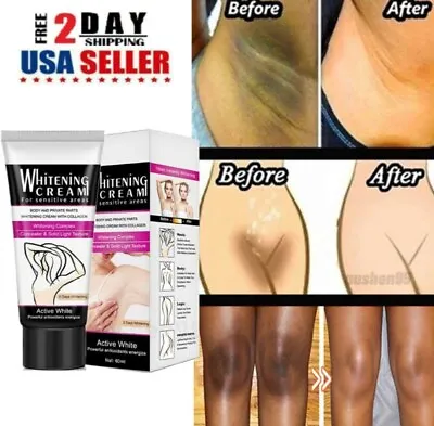 $9.35 • Buy Dark Skin Permanent Whitening Cream 3 DAY Body Bleaching Lightening Brightening