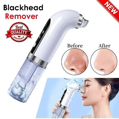 $24.99 • Buy Electric Blackhead Remover Vacuum Pore Acne Cleaner Machine Face Facial Suction